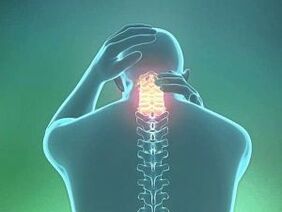 Simptomele osteocondrozei coloanei vertebrale toracice și tratamentul acesteia